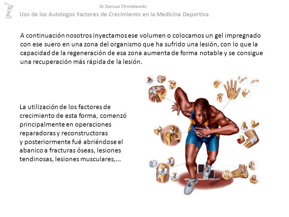 Uso de los Autologos Factores de Crecimiento en la Medicina Deportiva