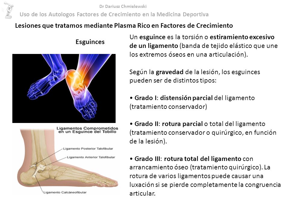 Lesiones que tratamos mediante Plasma Rico en Factores de Crecimiento