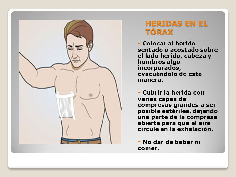 HERIDAS EN EL TÓRAX - Colocar al herido sentado o acostado sobre el lado herido, cabeza y hombros algo incorporados, evacuándolo de esta manera.