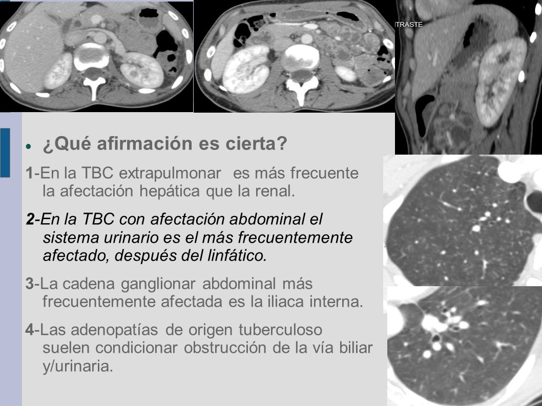 ¿Qué afirmación es cierta