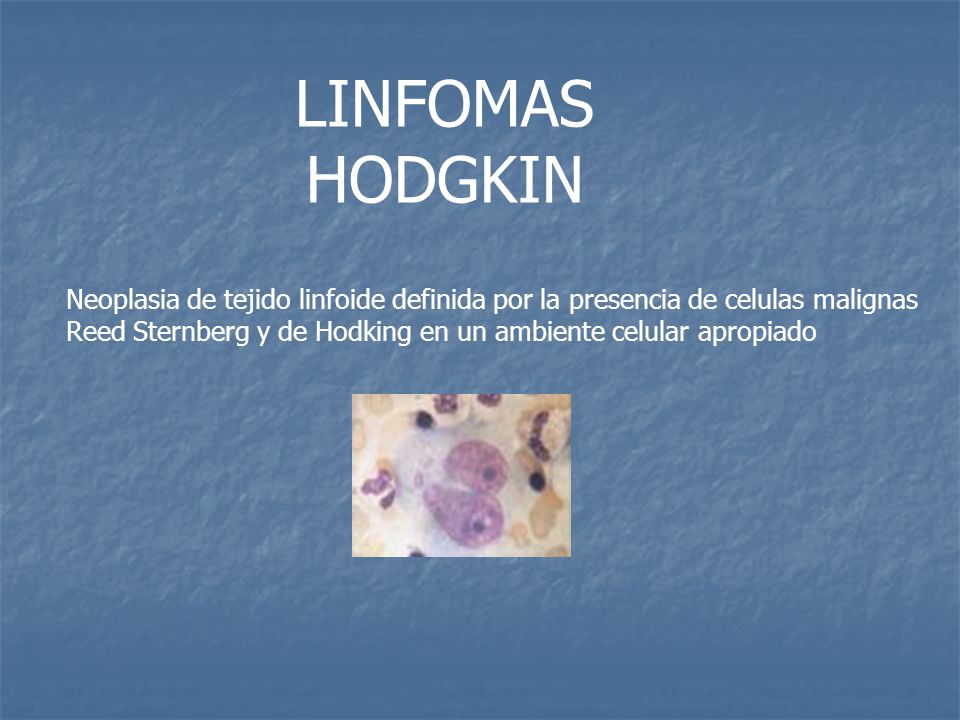 LINFOMAS HODGKIN Neoplasia de tejido linfoide definida por la presencia de celulas malignas.