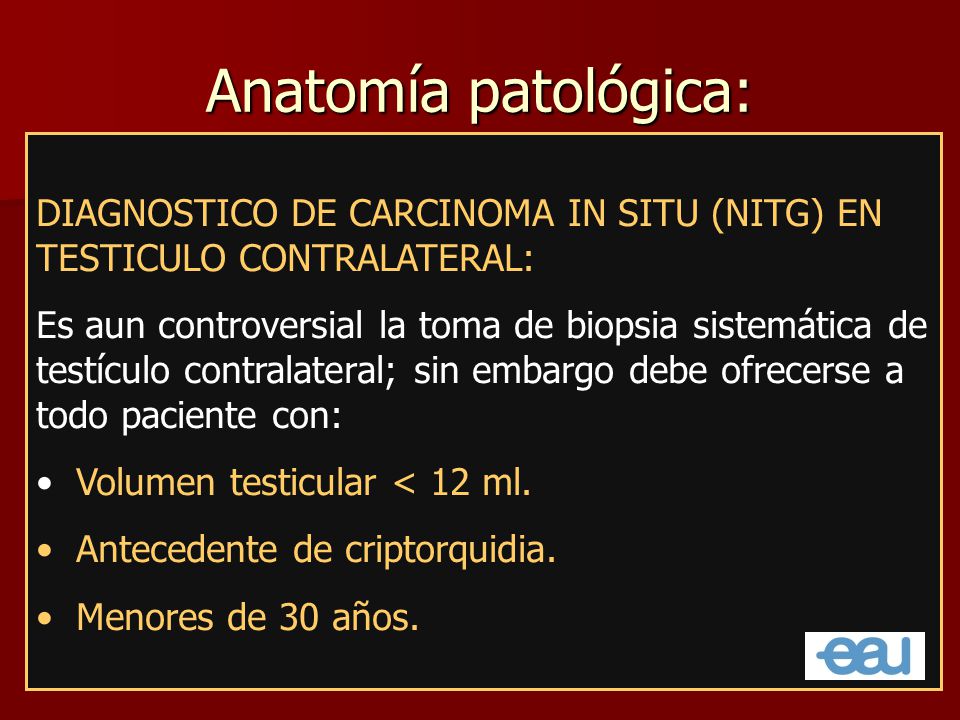 Anatomía patológica: DIAGNOSTICO DE CARCINOMA IN SITU (NITG) EN TESTICULO CONTRALATERAL: