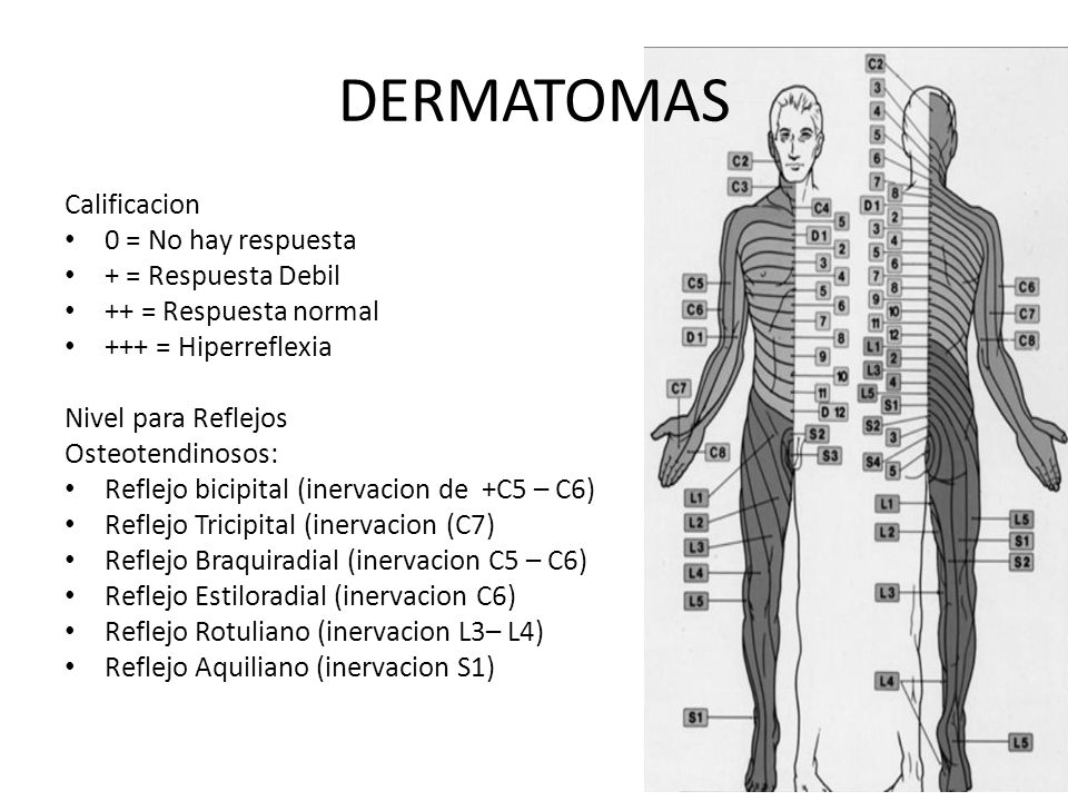 DERMATOMAS Calificacion 0 = No hay respuesta + = Respuesta Debil