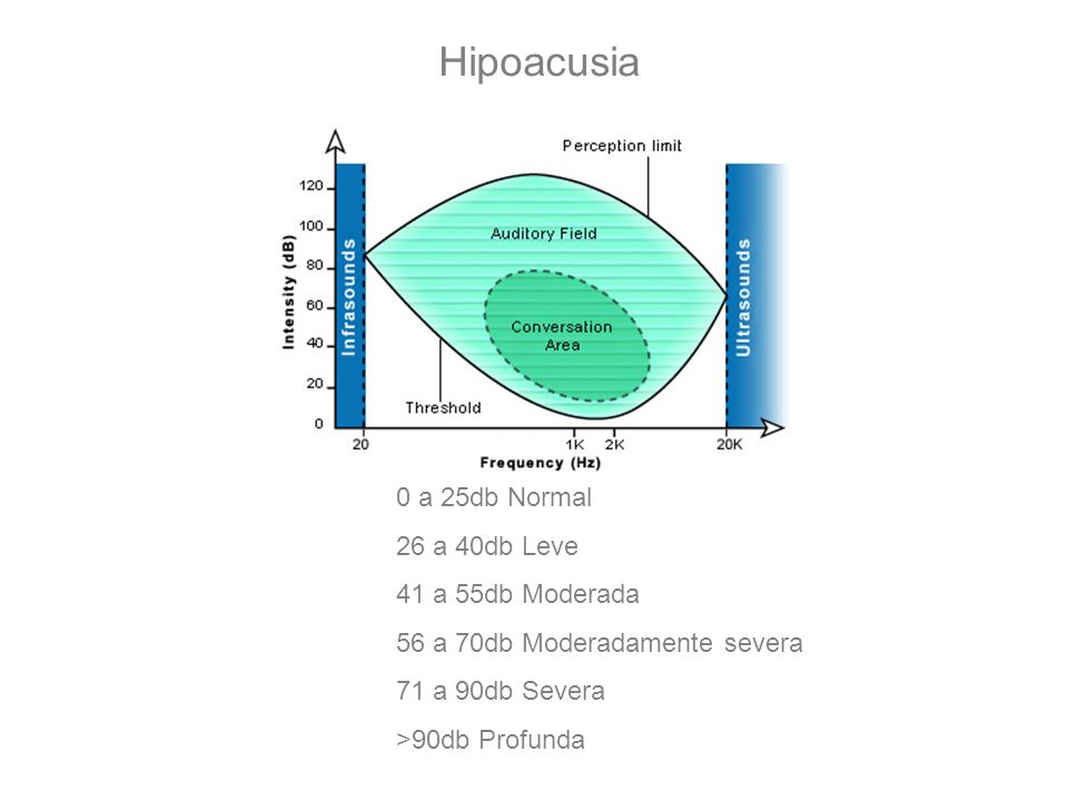 Hipoacusia 0 a 25db Normal 26 a 40db Leve 41 a 55db Moderada