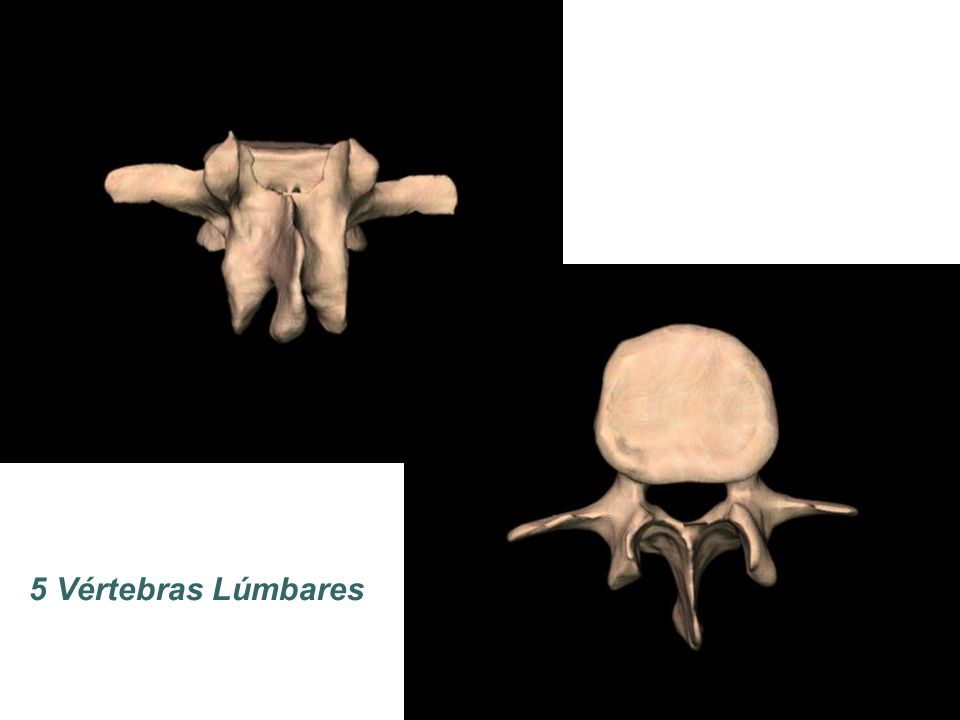 5 Vértebras Lúmbares
