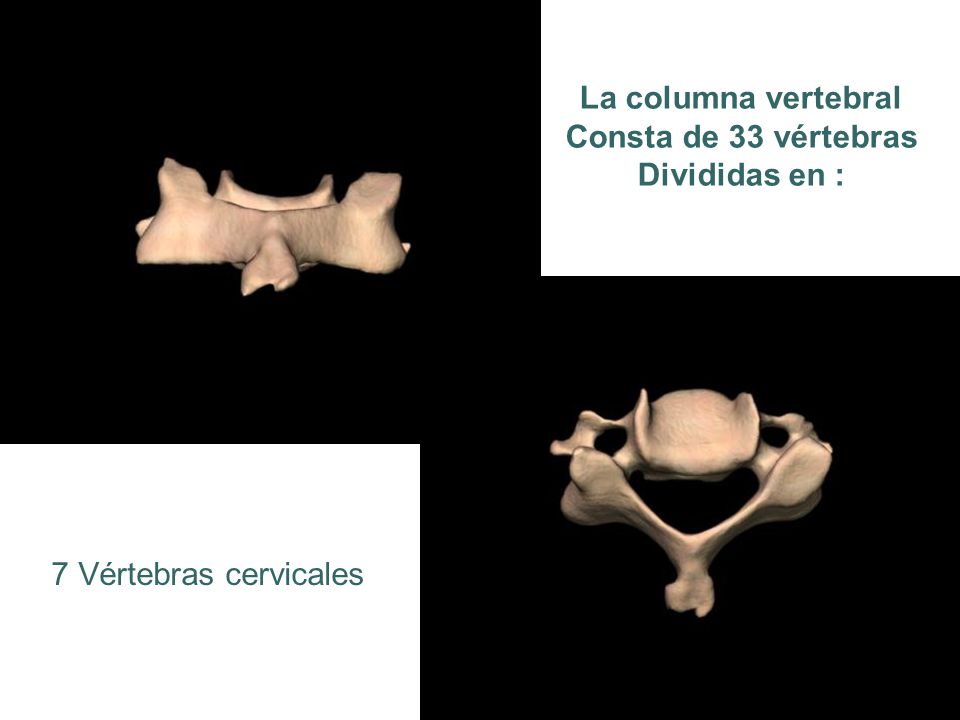 La columna vertebral Consta de 33 vértebras Divididas en : 7 Vértebras cervicales