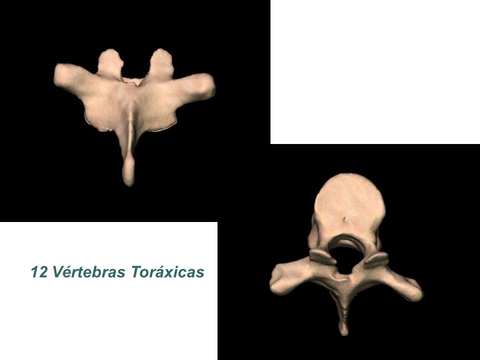 12 Vértebras Toráxicas
