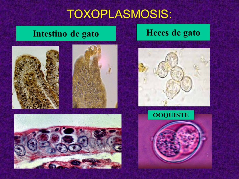 Toxoplasmosis Toxoplasma gondii - ppt video online descargar