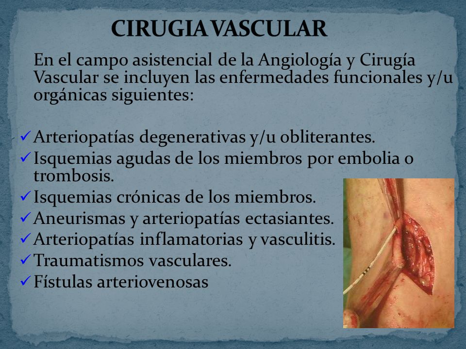 CIRUGIA VASCULAR En el campo asistencial de la Angiología y Cirugía Vascular se incluyen las enfermedades funcionales y/u orgánicas siguientes: