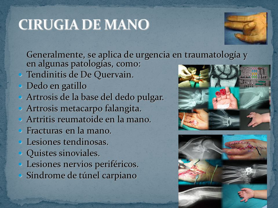 Generalmente, se aplica de urgencia en traumatología y en algunas patologías, como: