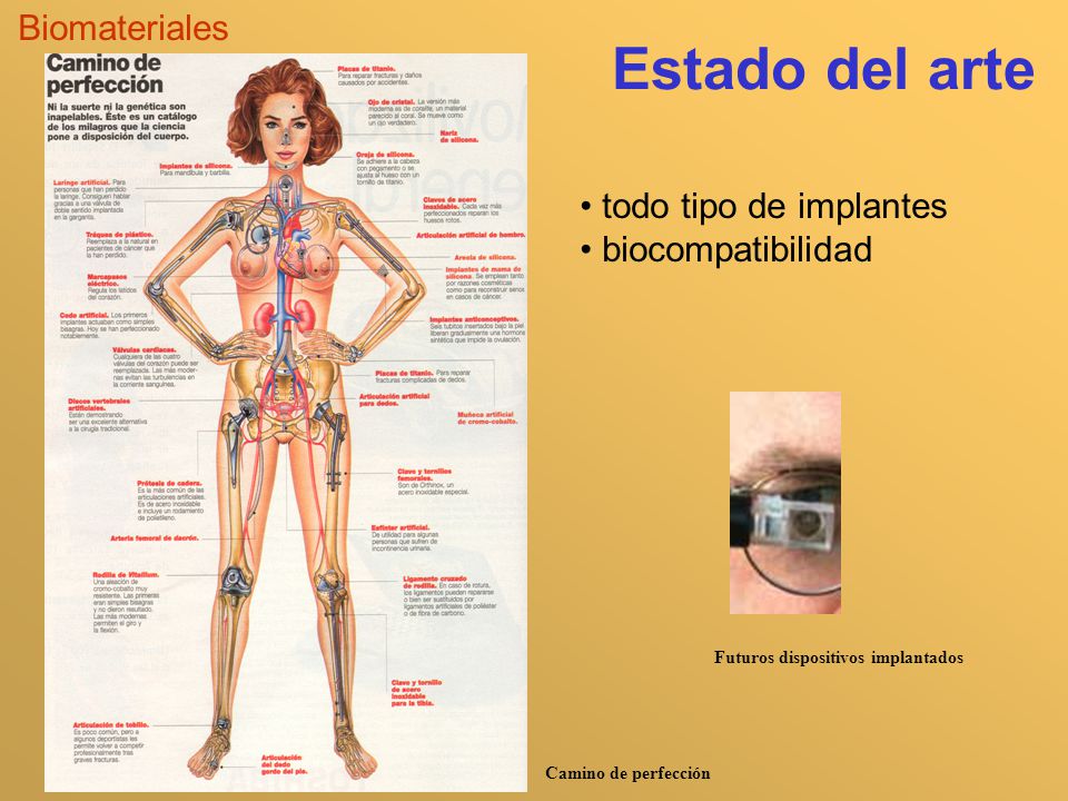 Estado del arte Biomateriales todo tipo de implantes biocompatibilidad