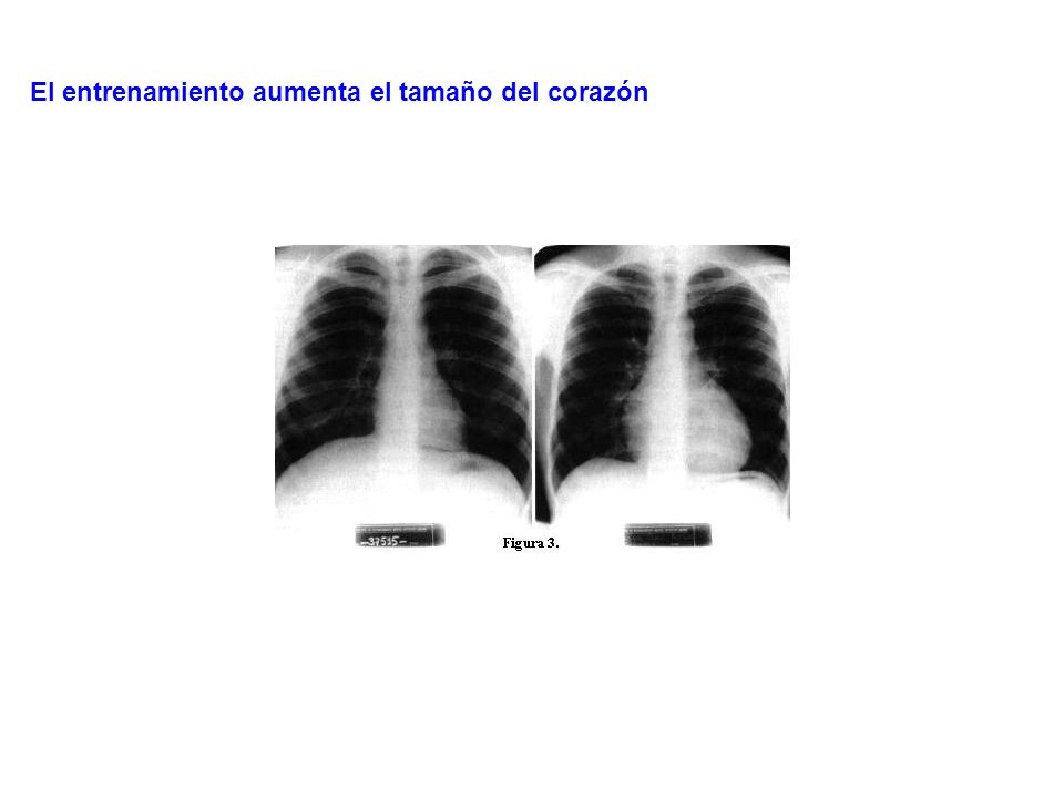 El entrenamiento aumenta el tamaño del corazón