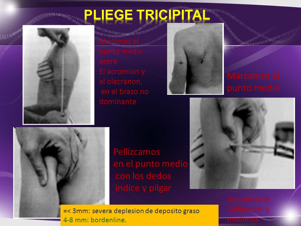 PLIEGE TRICIPITAL Marcamos el punto medio Pellizcamos