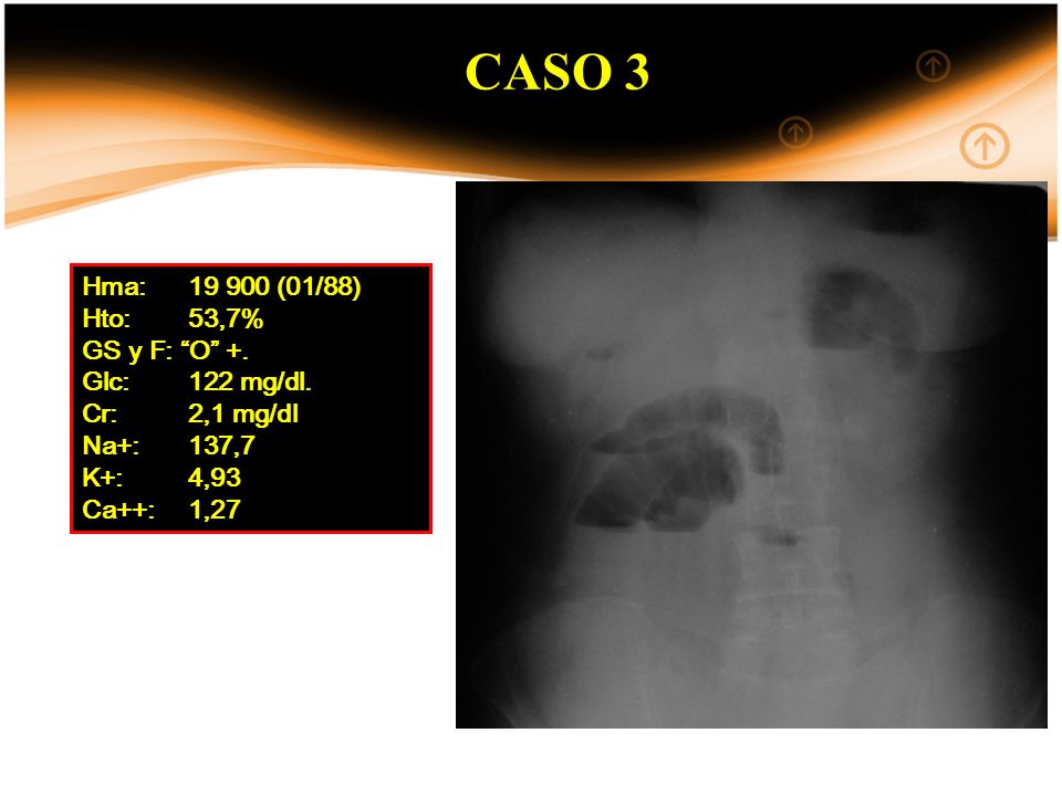 CASO 3 Hma: (01/88) Hto: 53,7% GS y F: O +. Glc: 122 mg/dl.