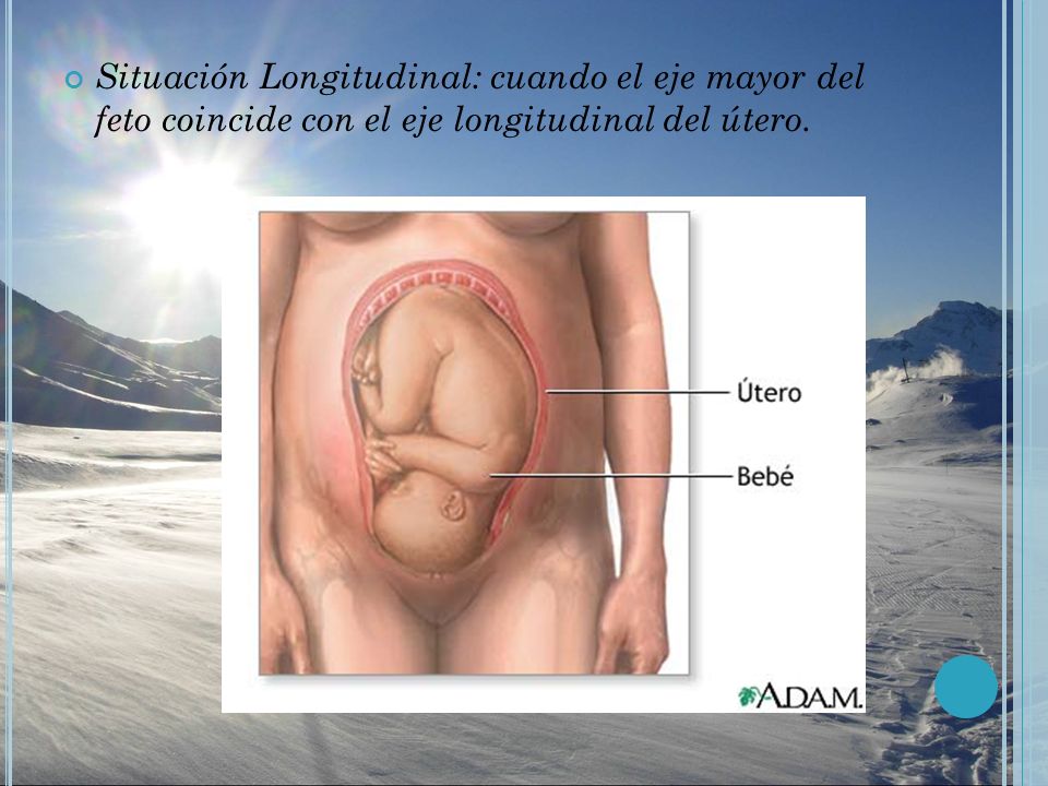 Situación Longitudinal: cuando el eje mayor del feto coincide con el eje longitudinal del útero.