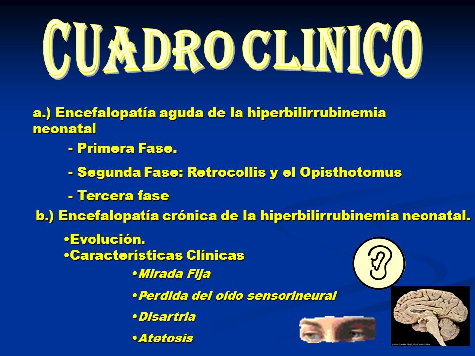 cuadro clinico a.) Encefalopatía aguda de la hiperbilirrubinemia neonatal. - Primera Fase. - Segunda Fase: Retrocollis y el Opisthotomus.