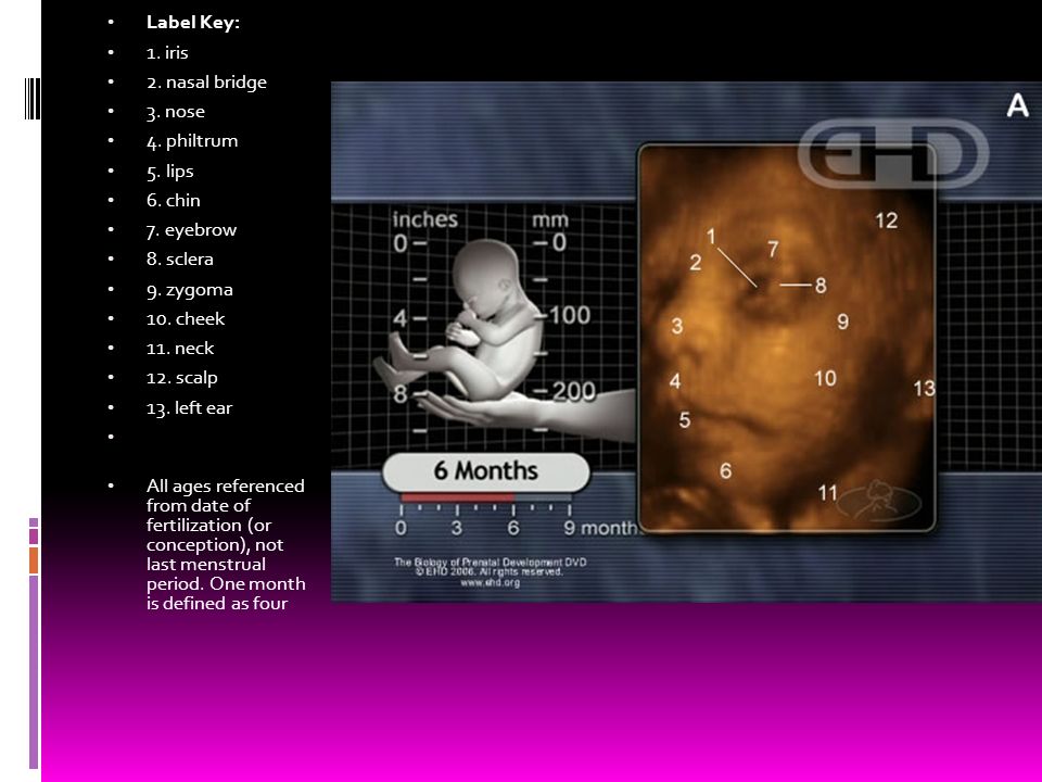 Label Key: 1. iris. 2. nasal bridge. 3. nose. 4. philtrum. 5. lips. 6. chin. 7. eyebrow. 8. sclera.
