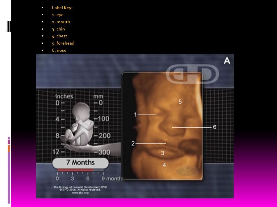 Label Key: 1. eye 2. mouth 3. chin 4. chest 5. forehead 6. nose