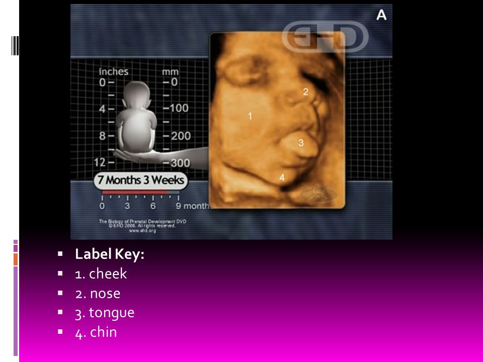 Label Key: 1. cheek 2. nose 3. tongue 4. chin