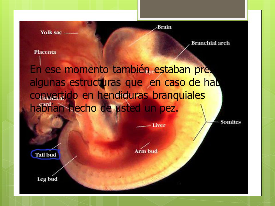 En ese momento también estaban presentes algunas estructuras que en caso de haberse convertido en hendiduras branquiales habrían hecho de usted un pez.