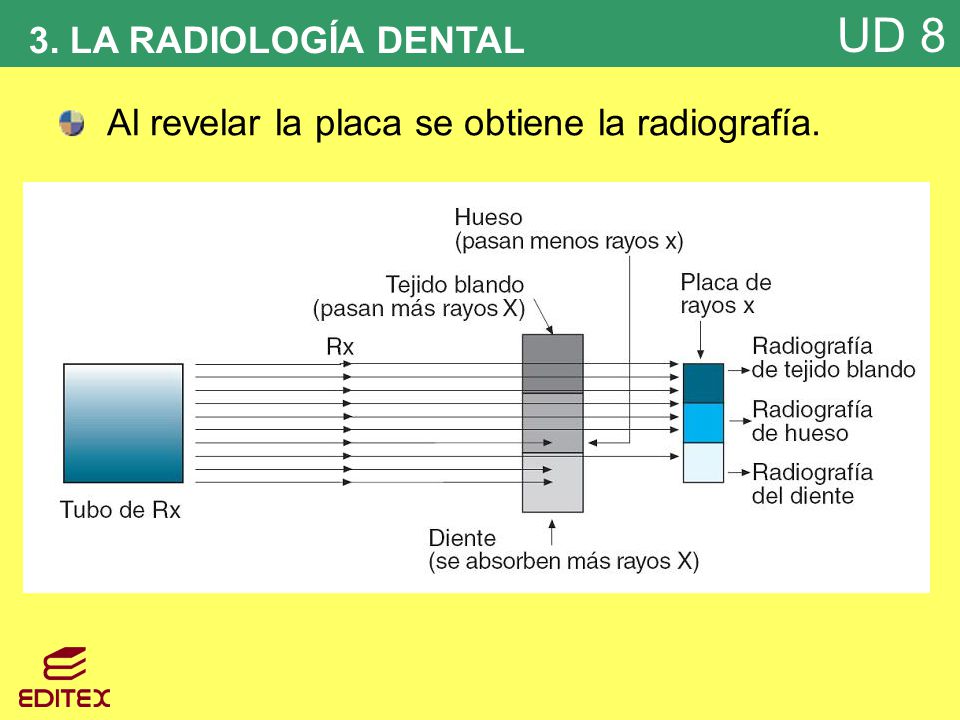 3. LA RADIOLOGÍA DENTAL Al revelar la placa se obtiene la radiografía.
