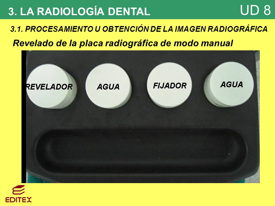 3. LA RADIOLOGÍA DENTAL 3.1. PROCESAMIENTO U OBTENCIÓN DE LA IMAGEN RADIOGRÁFICA.
