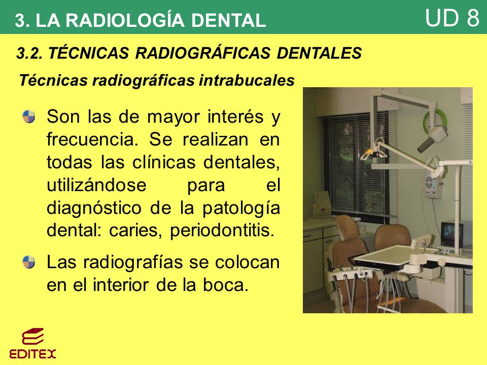 Las radiografías se colocan en el interior de la boca.