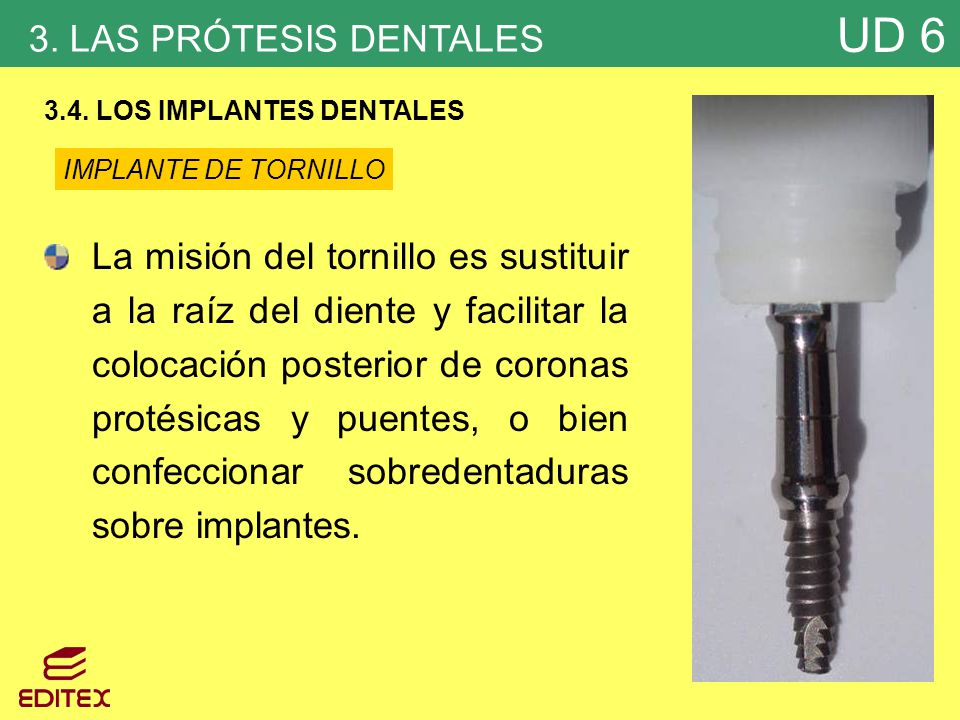 3. LAS PRÓTESIS DENTALES 3.4. LOS IMPLANTES DENTALES. IMPLANTE DE TORNILLO.