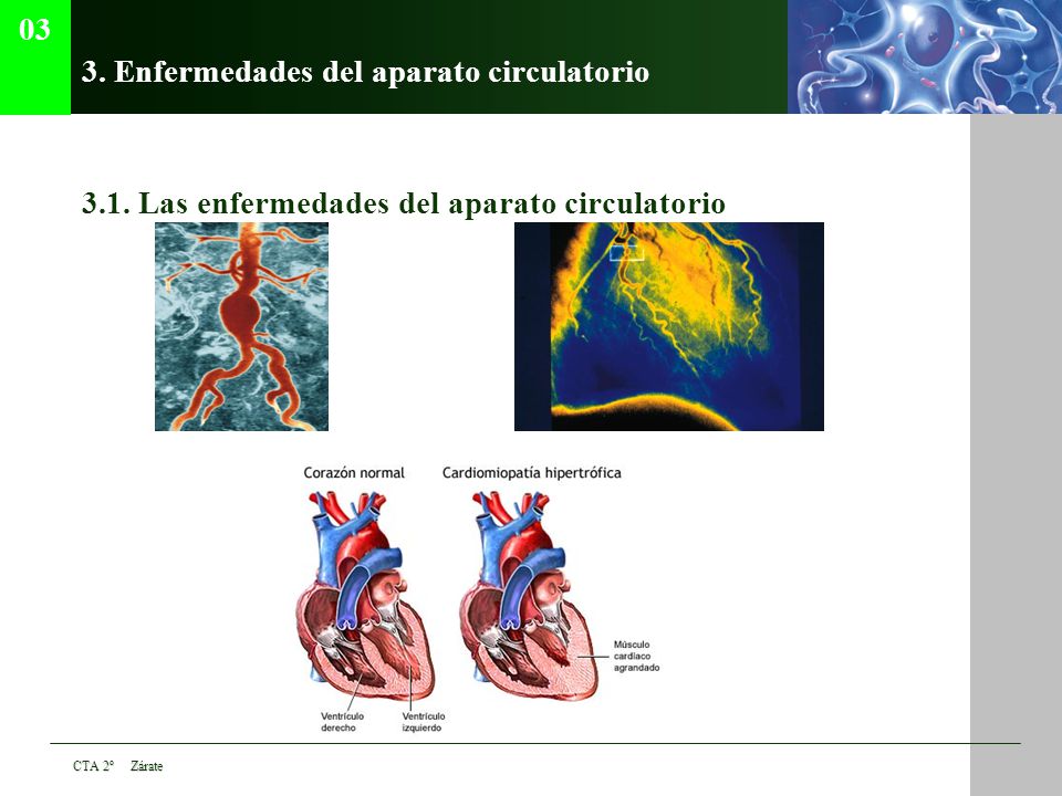 3. Enfermedades del aparato circulatorio