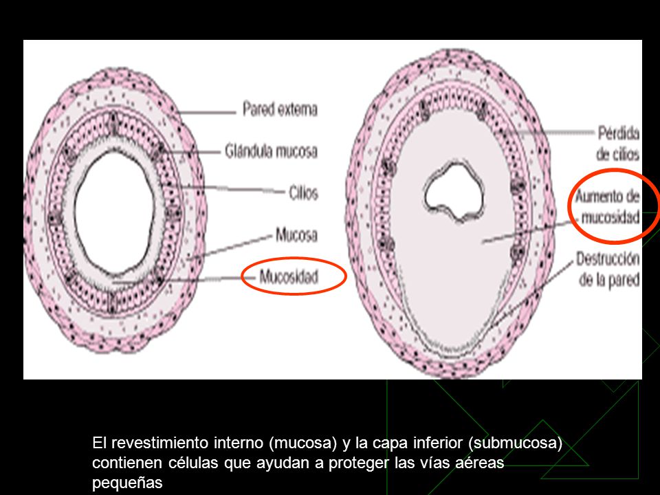 El revestimiento interno (mucosa) y la capa inferior (submucosa) contienen células que ayudan a proteger las vías aéreas pequeñas
