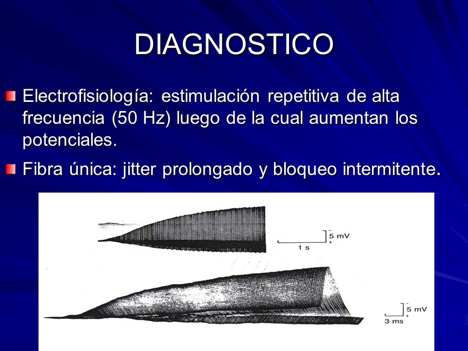 DIAGNOSTICO Electrofisiología: estimulación repetitiva de alta frecuencia (50 Hz) luego de la cual aumentan los potenciales.