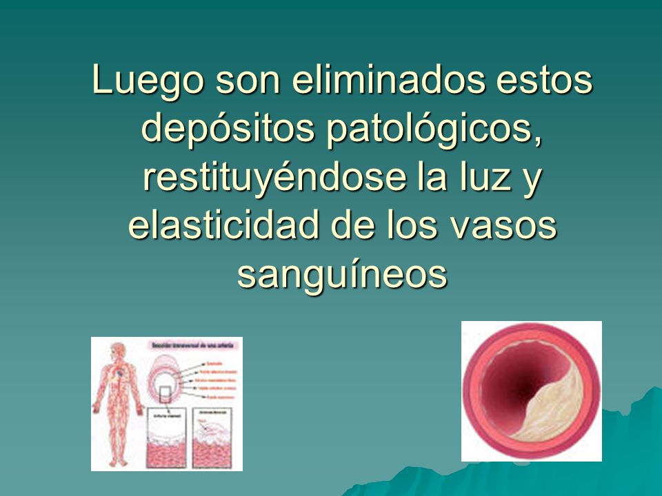 Luego son eliminados estos depósitos patológicos, restituyéndose la luz y elasticidad de los vasos sanguíneos