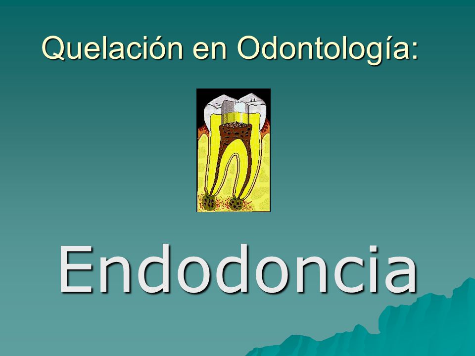 Quelación en Odontología: