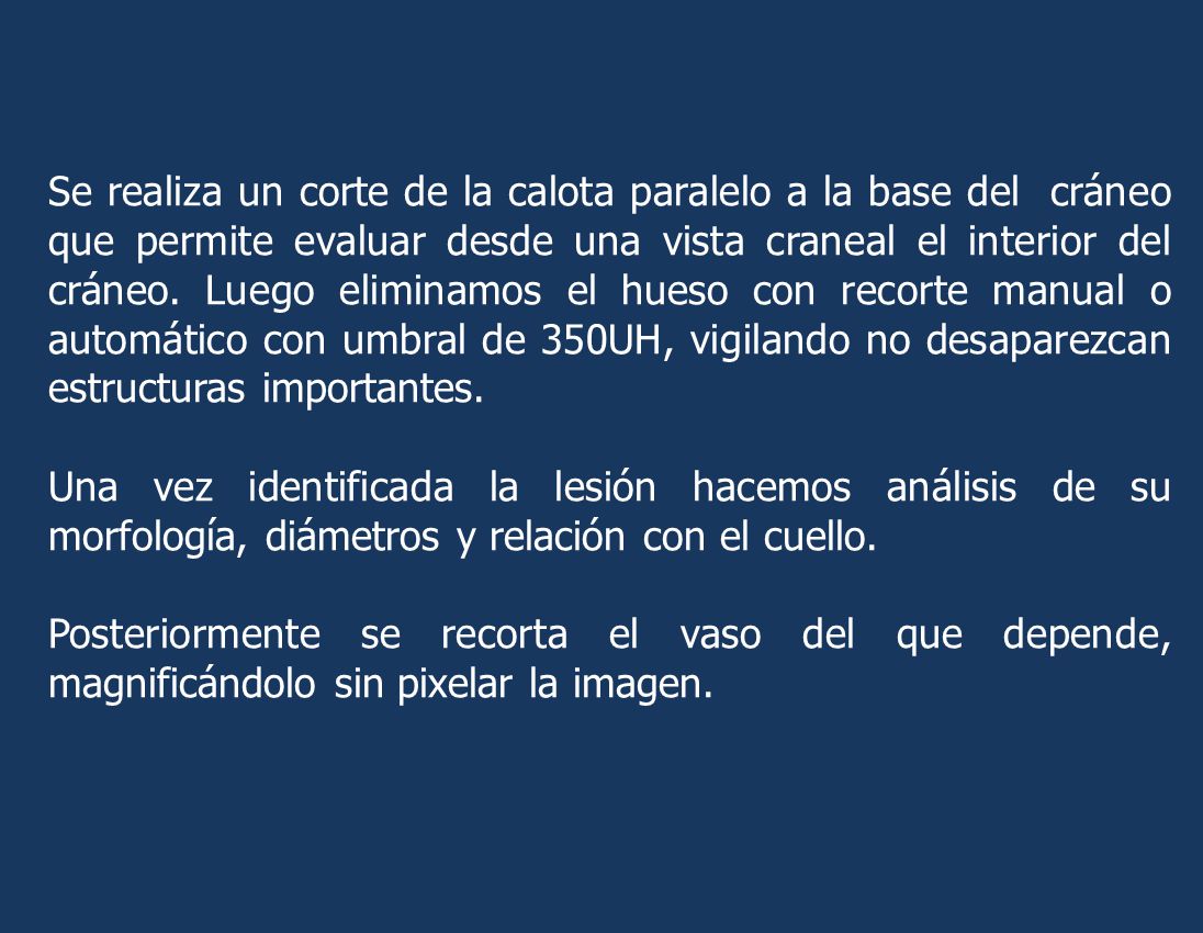 Se realiza un corte de la calota paralelo a la base del cráneo que permite evaluar desde una vista craneal el interior del cráneo. Luego eliminamos el hueso con recorte manual o automático con umbral de 350UH, vigilando no desaparezcan estructuras importantes.
