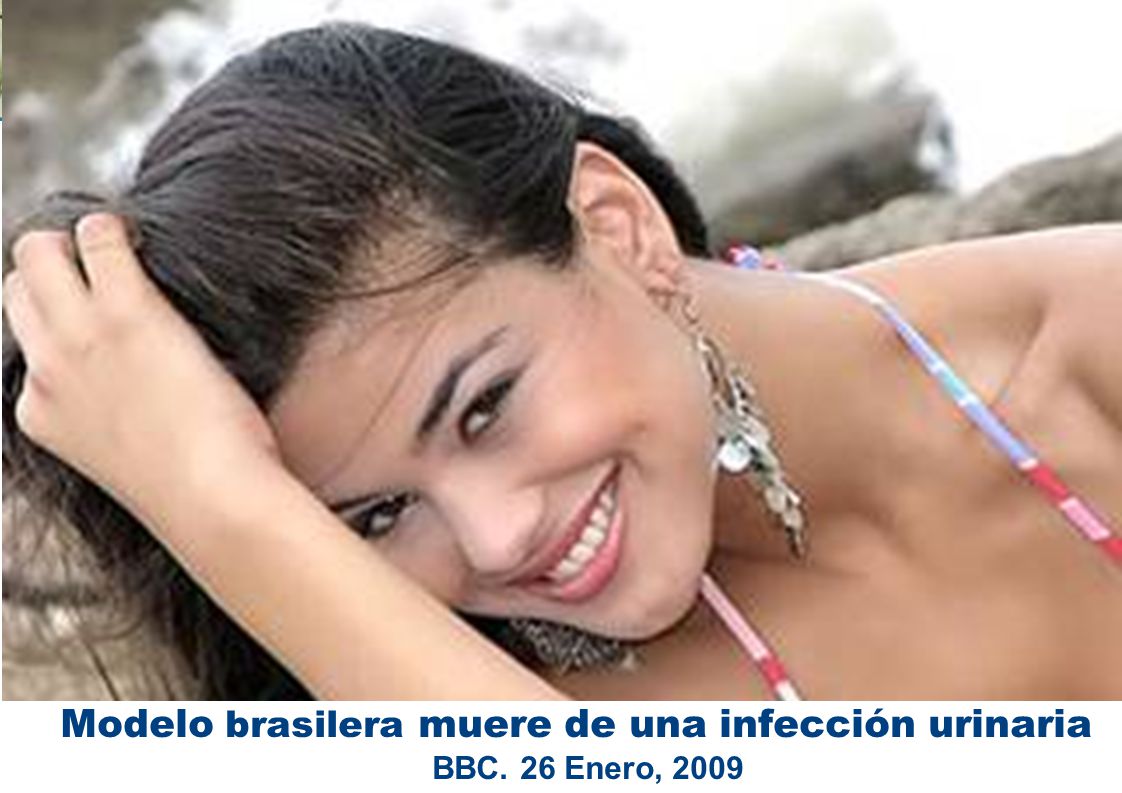 Modelo brasilera muere de una infección urinaria BBC. 26 Enero, 2009