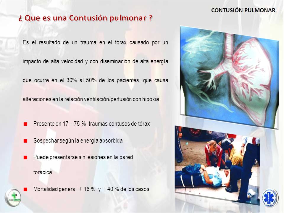 Es el resultado de un trauma en el tórax causado por un impacto de alta velocidad y con diseminación de alta energía que ocurre en el 30% al 50% de los pacientes, que causa alteraciones en la relación ventilación/perfusión con hipoxia