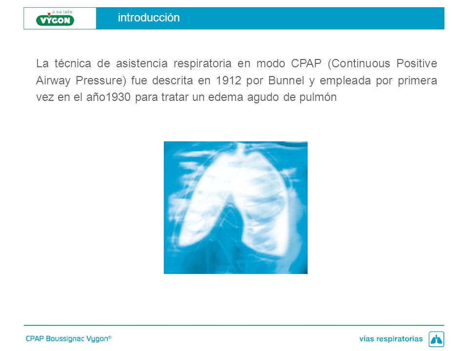 introducción La técnica de asistencia respiratoria en modo CPAP (Continuous Positive.