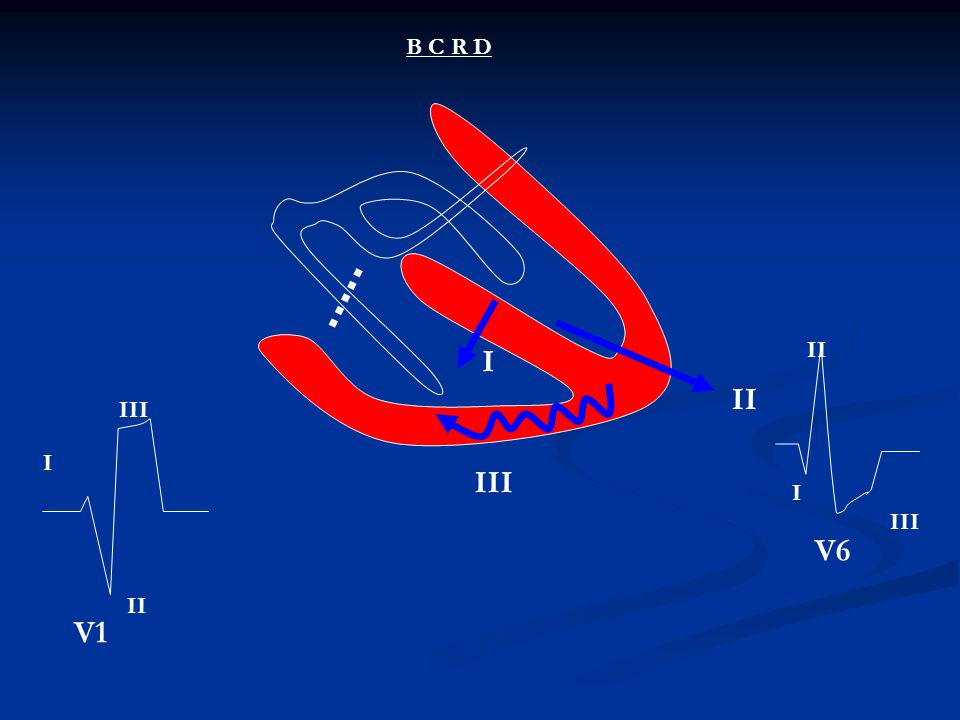 B C R D II I II III I III I III V6 II V1