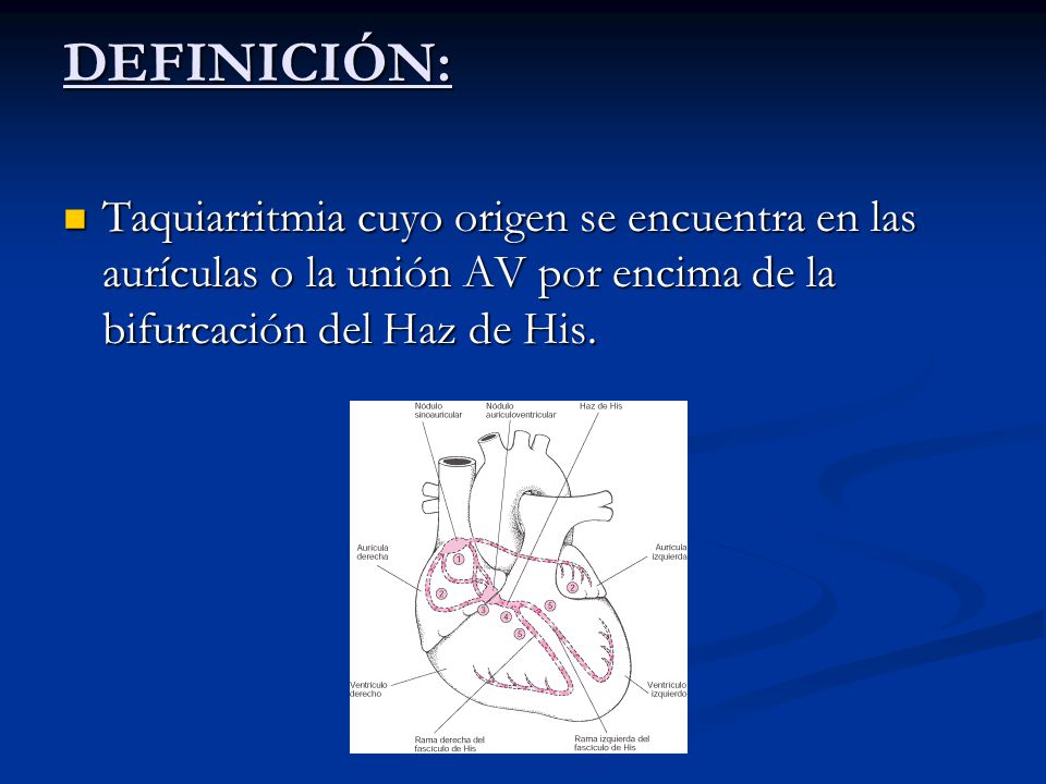 DEFINICIÓN: Taquiarritmia cuyo origen se encuentra en las aurículas o la unión AV por encima de la bifurcación del Haz de His.