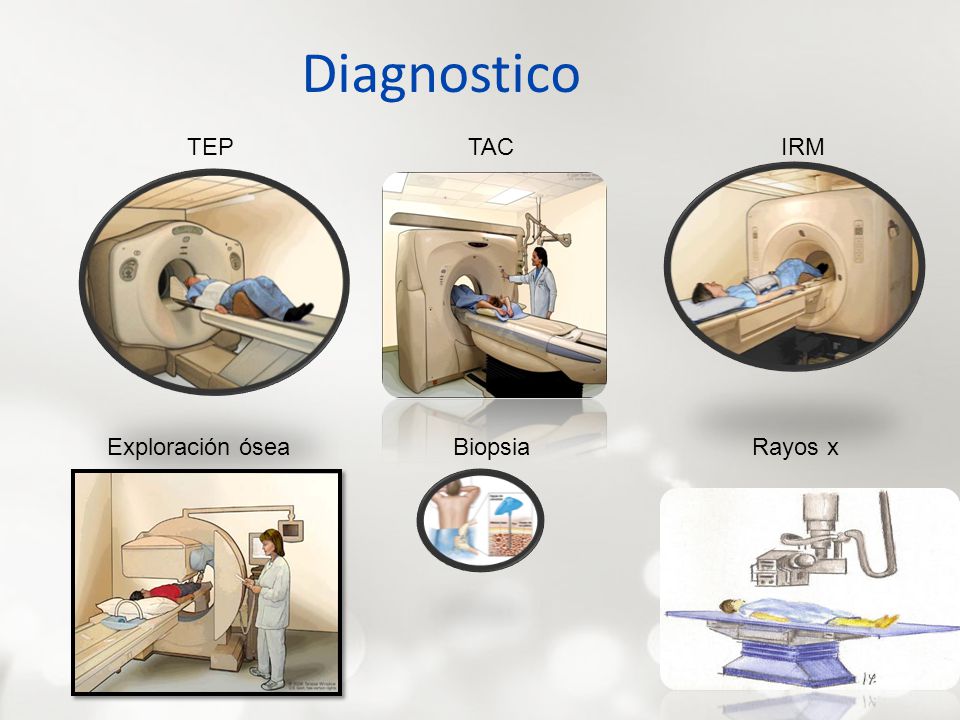 Diagnostico TEP TAC IRM Exploración ósea Biopsia Rayos x