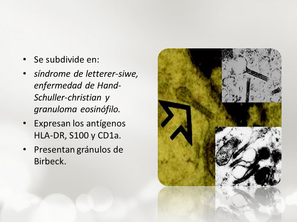 Se subdivide en: síndrome de letterer-siwe, enfermedad de Hand-Schuller-christian y granuloma eosinófilo.