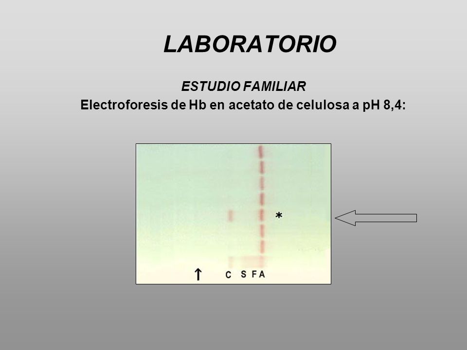 Electroforesis de Hb en acetato de celulosa a pH 8,4:
