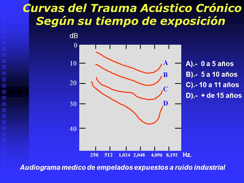 Curvas del Trauma Acústico Crónico Según su tiempo de exposición