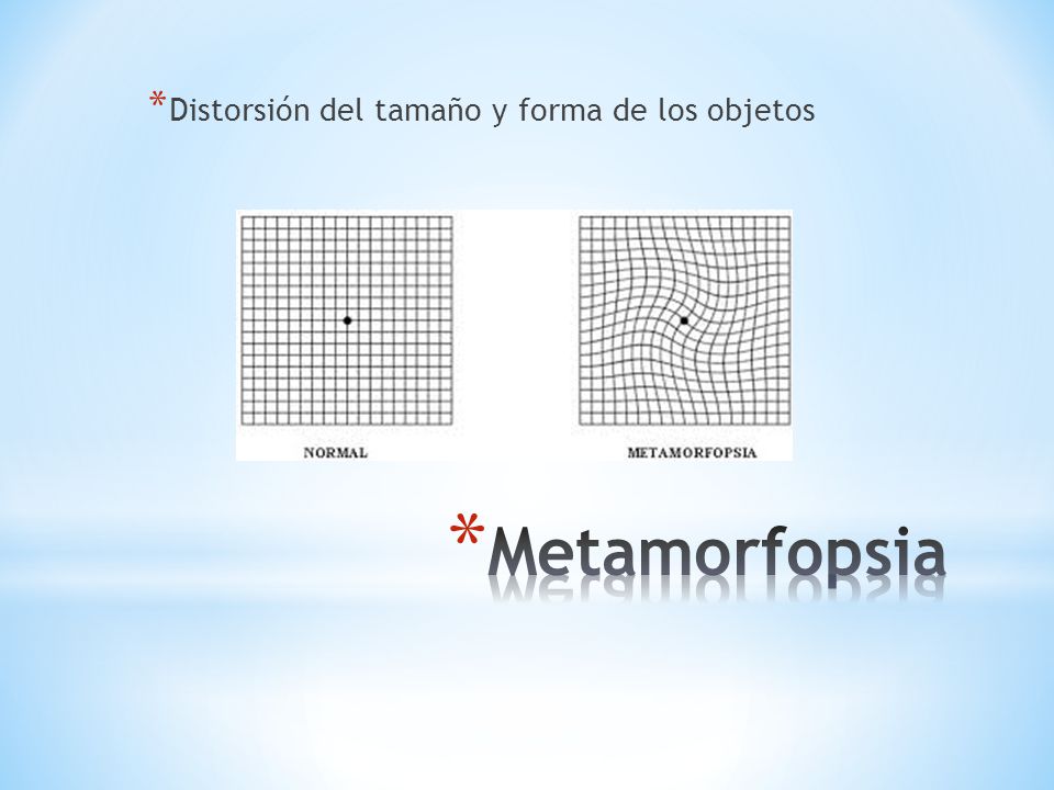 Distorsión del tamaño y forma de los objetos
