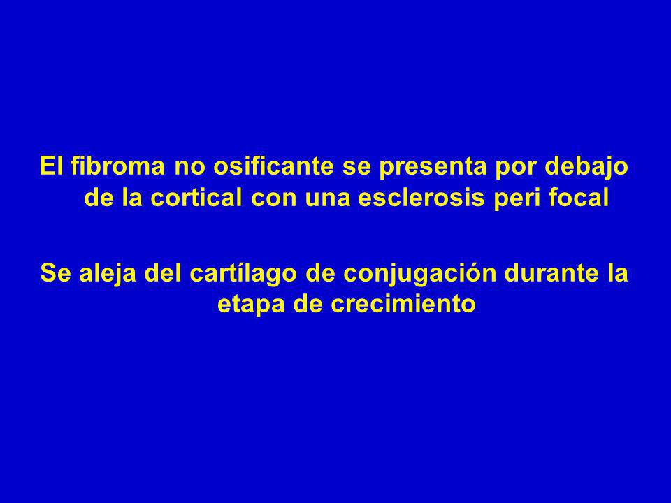 Se aleja del cartílago de conjugación durante la etapa de crecimiento