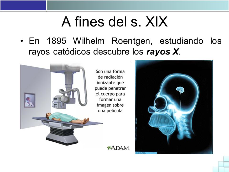 A fines del s. XIX En 1895 Wilhelm Roentgen, estudiando los rayos catódicos descubre los rayos X.