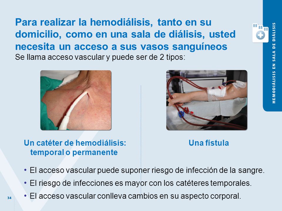 Para realizar la hemodiálisis, tanto en su domicilio, como en una sala de diálisis, usted necesita un acceso a sus vasos sanguíneos