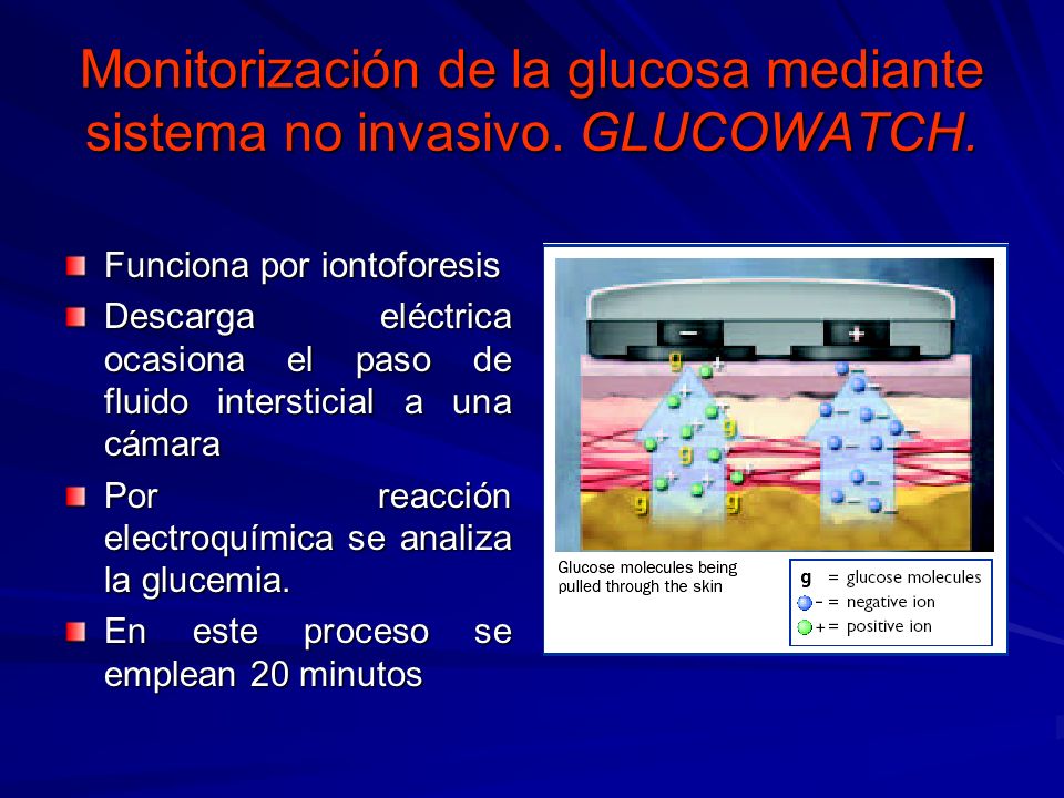 Monitorización de la glucosa mediante sistema no invasivo. GLUCOWATCH.