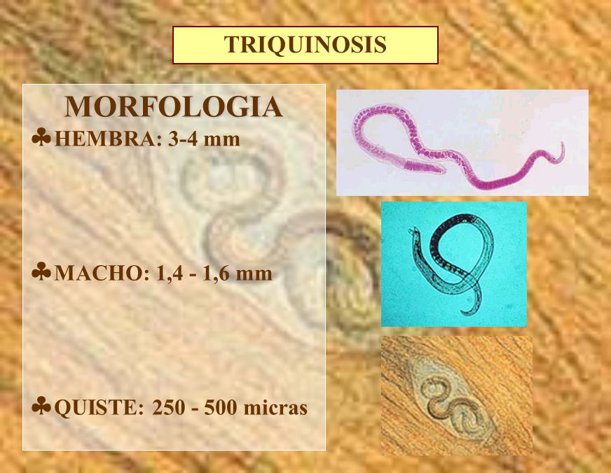 MORFOLOGIA TRIQUINOSIS HEMBRA: 3-4 mm MACHO: 1,4 - 1,6 mm