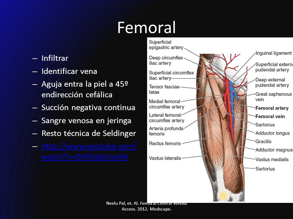 Neelu Pal, et. Al. Femoral Central Venous Access Medscape.